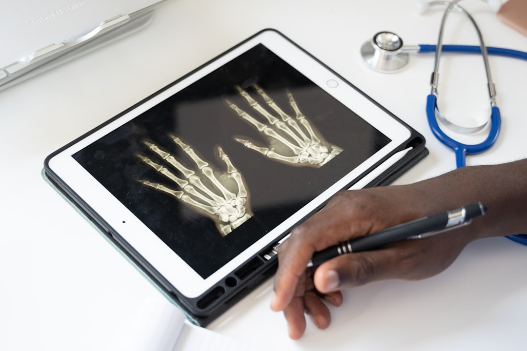 Hand Xray Evaluation by A Doctor Doctor reading digital x-ray of a hand on a tablet